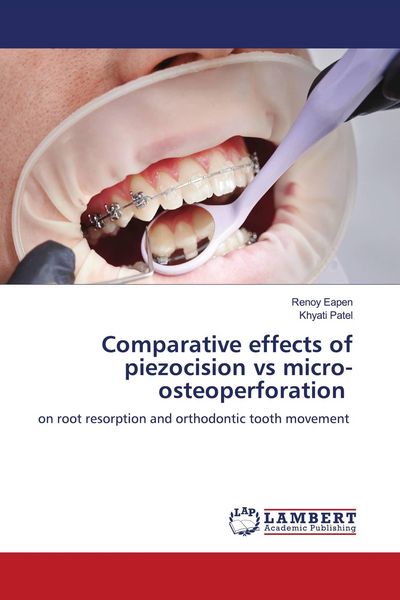 Produktbild: Comparative effects of piezocision vs micro-osteoperforation