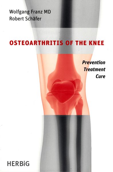 Produktbild: Osteoarthritis of the knee