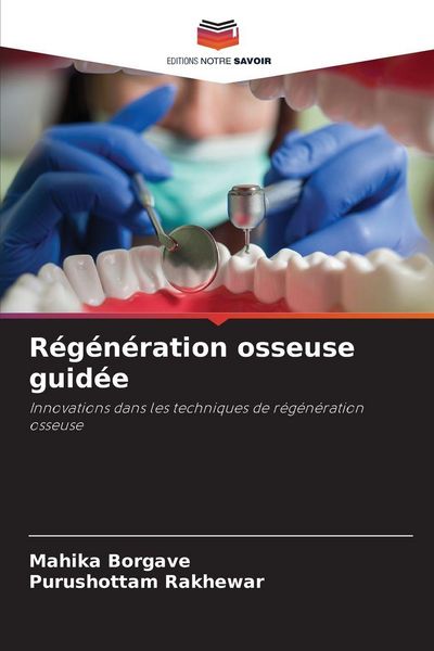 Produktbild: R&eacute;g&eacute;n&eacute;ration osseuse guid&eacute;e