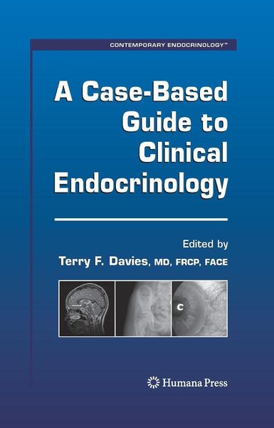 Produktbild: A Case-Based Guide to Clinical Endocrinology