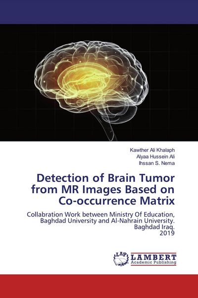 Produktbild: Detection of Brain Tumor from MR Images Based on Co-occurrence Matrix