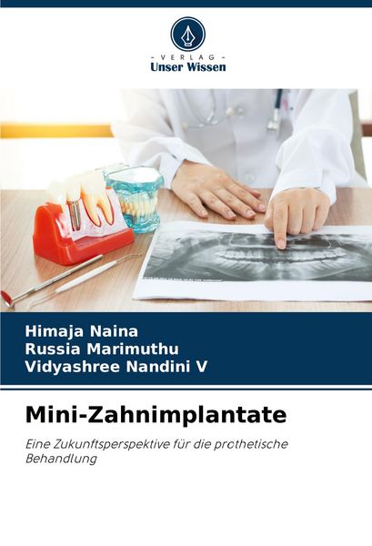 Mini-Zahnimplantate, Taschenbuch von Himaja Naina , Russia Marimuthu , Vidyashree Nandini V., Verlag Unser Wissen, 9786206859222