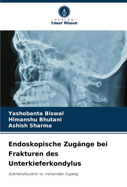 Endoskopische Zugänge bei Frakturen des Unterkieferkondylus, Taschenbuch von Yashobanta Biswal , Himanshu Bhutani , Ashish Sharma, Verlag Unser