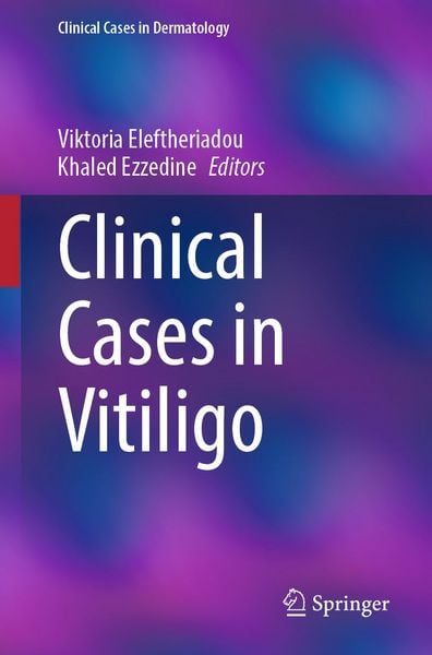 Produktbild: Clinical Cases in Vitiligo
