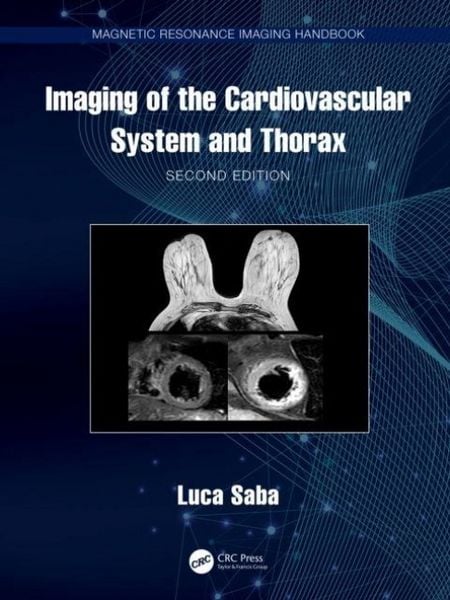Produktbild: Imaging of the Cardiovascular System and Thorax
