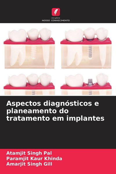 Produktbild: Aspectos diagn&oacute;sticos e planeamento do tratamento em implantes