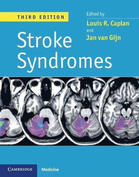 Produktbild: Stroke Syndromes, 3ed