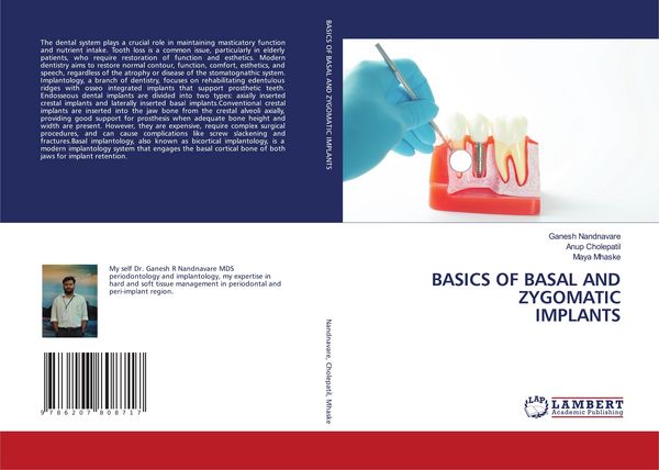 Produktbild: BASICS OF BASAL AND ZYGOMATIC IMPLANTS