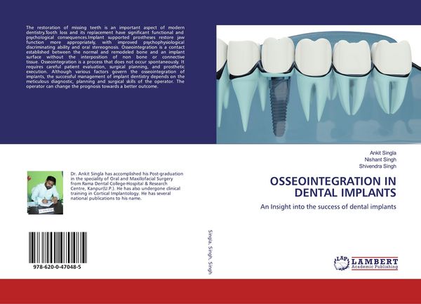 Produktbild: Osseointegration in Dental Implants
