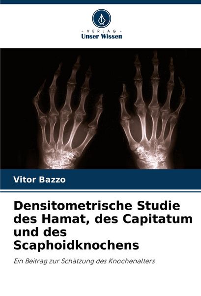 Produktbild: Densitometrische Studie des Hamat, des Capitatum und des Scaphoidknochens