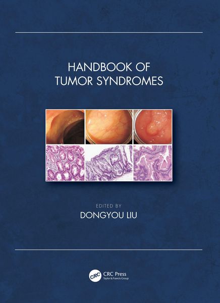 Produktbild: Handbook of Tumor Syndromes