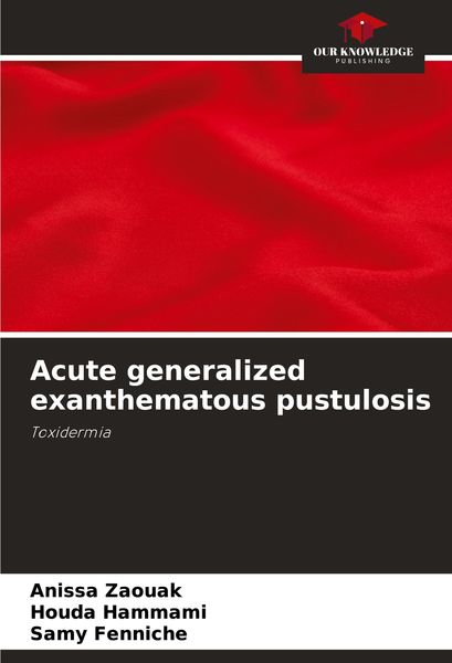 Produktbild: Acute generalized exanthematous pustulosis