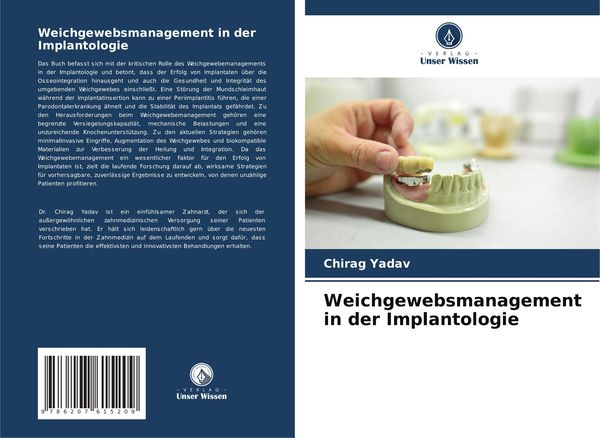 Weichgewebsmanagement in der Implantologie, Taschenbuch von Chirag Yadav, Verlag Unser Wissen, 9786207615209