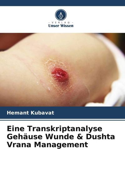 Eine Transkriptanalyse Gehäuse Wunde & Dushta Vrana Management, Taschenbuch von Hemant Kubavat, Verlag Unser Wissen, 9786205413791