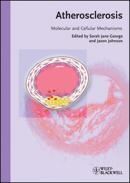 Produktbild: Atherosclerosis