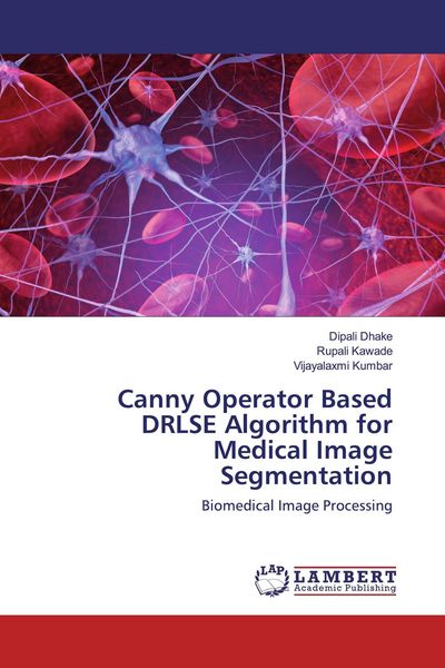 Produktbild: Canny Operator Based DRLSE Algorithm for Medical Image Segmentation