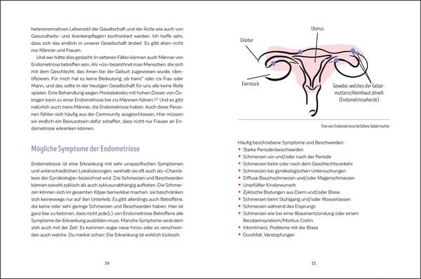 Produktbild: Leben mit Endometriose
