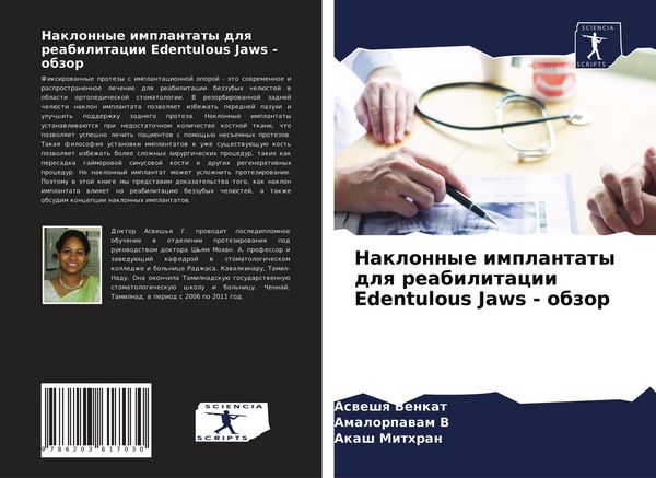 Produktbild: Naklonnye implantaty dlq reabilitacii Edentulous Jaws - obzor