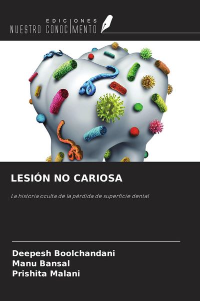 Produktbild: Lesi&oacute;n No Cariosa