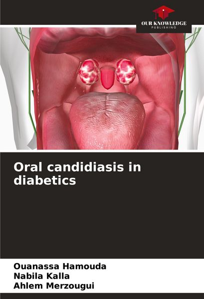 Produktbild: Oral candidiasis in diabetics