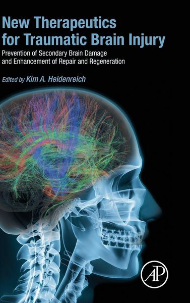 Produktbild: New Therapeutics for Traumatic Brain Injury
