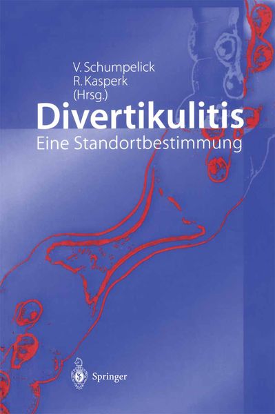 Divertikulitis, Taschenbuch von Volker Schumpelick , Reinhard Kasperk, Springer Berlin, 9783540420446