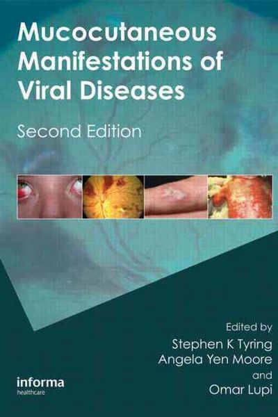 Produktbild: Mucocutaneous Manifestations of Viral Diseases