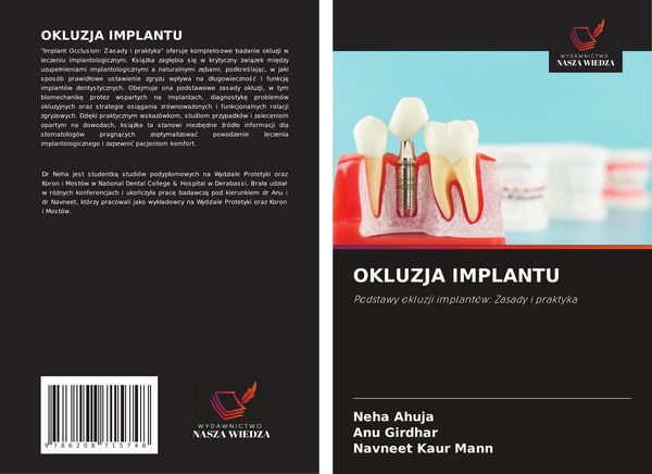 Produktbild: Okluzja Implantu