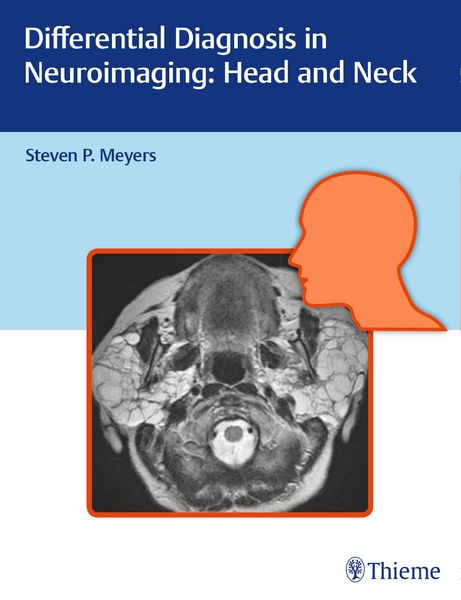 Produktbild: Differential Diagnosis in Neuroimaging: Head and Neck