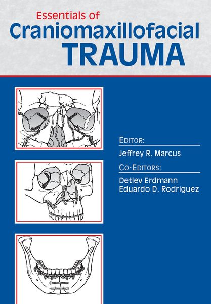 Produktbild: Essentials of Craniomaxillofacial Trauma