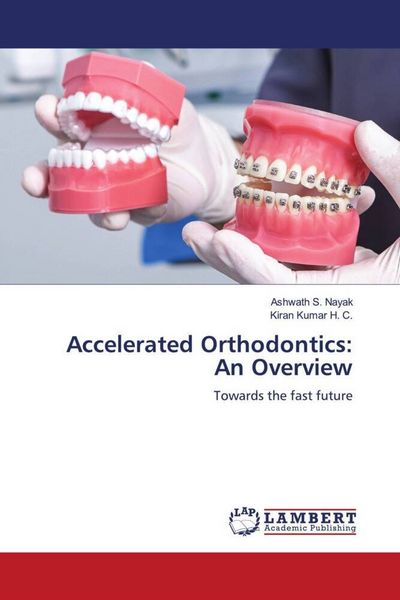 Produktbild: Accelerated Orthodontics: An Overview