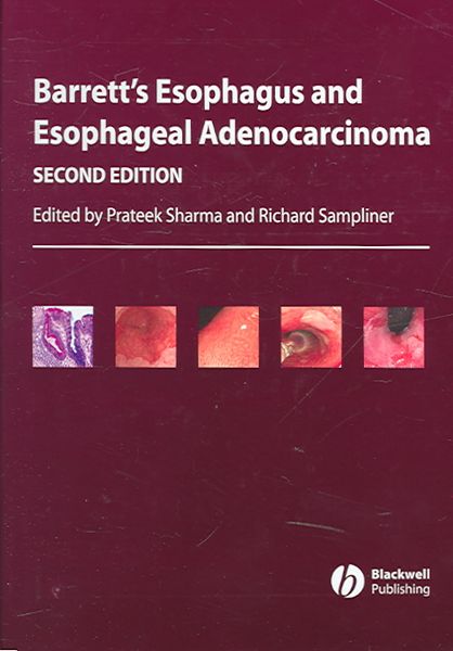 Produktbild: Sharma, P: Barrett&prime;s Esophagus and Esophageal Adenocar