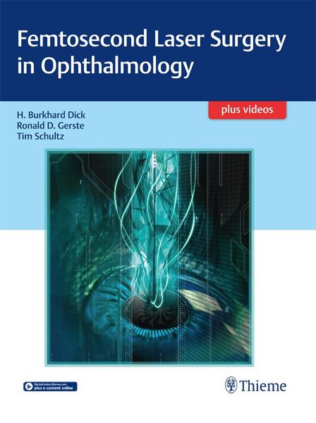 Produktbild: Femtosecond Laser Surgery in Ophthalmology
