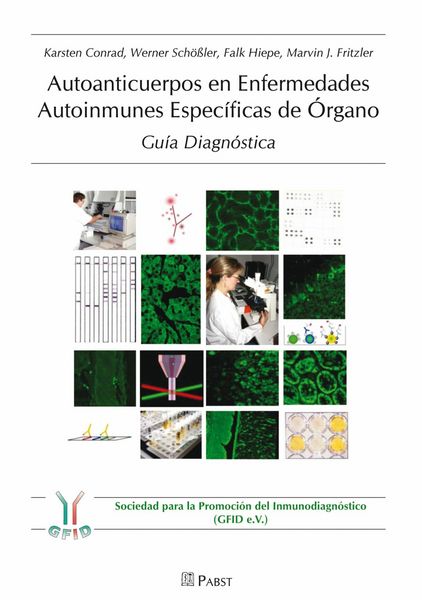 Produktbild: Autoanticuerpos en Enfermedades Autoinmunes Espec&iacute;ficas de &Oacute;rgano - Gu&iacute;a Diagn&oacute;stica