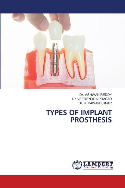 Produktbild: Types Of Implant Prosthesis