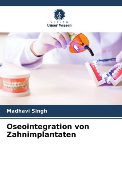 Produktbild: Oseointegration von Zahnimplantaten
