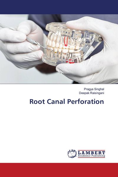 Produktbild: Root Canal Perforation
