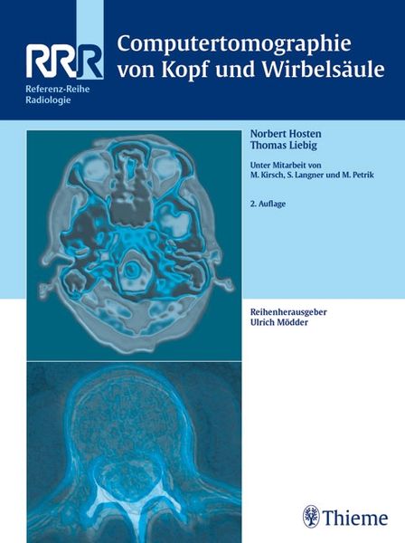 Produktbild: Computertomographie von Kopf und Wirbels&auml;ule
