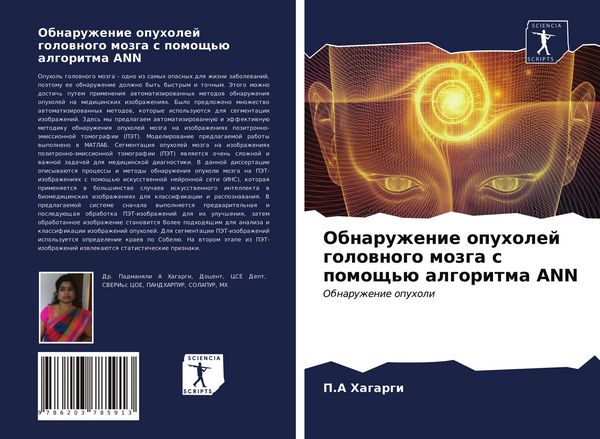 Produktbild: Obnaruzhenie opuholej golownogo mozga s pomosch'&uuml; algoritma ANN