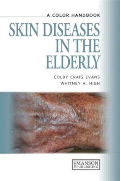 Produktbild: COLOR HANDBOOK SKIN DISEASES I