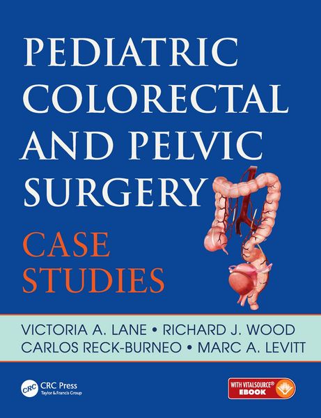Produktbild: Pediatric Colorectal and Pelvic Surgery