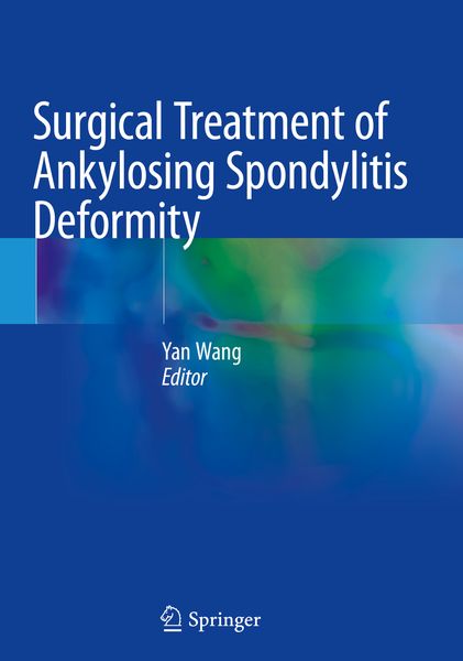 Produktbild: Surgical Treatment of Ankylosing Spondylitis Deformity