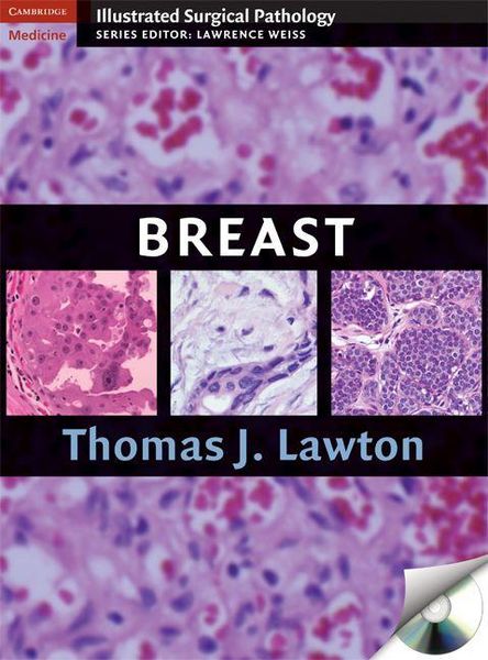 Produktbild: Illustrated Surgical Pathology of the Breast