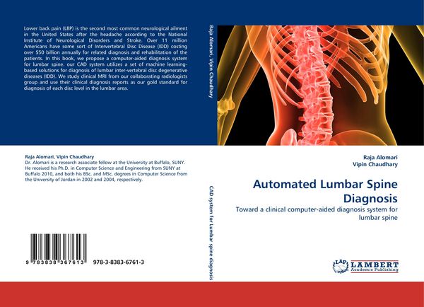 Produktbild: Automated Lumbar Spine Diagnosis
