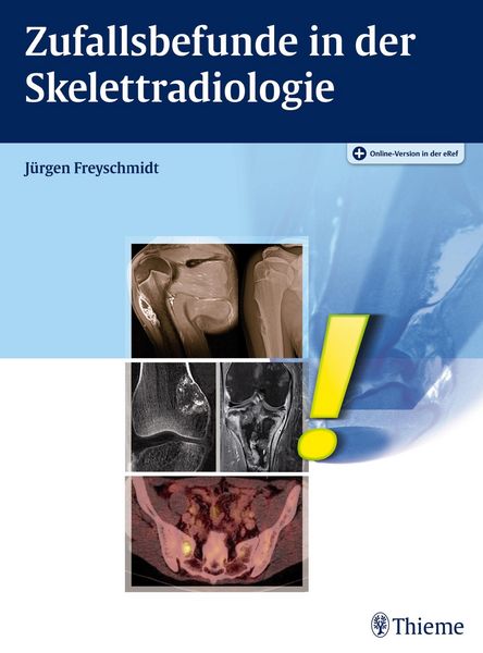 Produktbild: Zufallsbefunde in der Skelettradiologie
