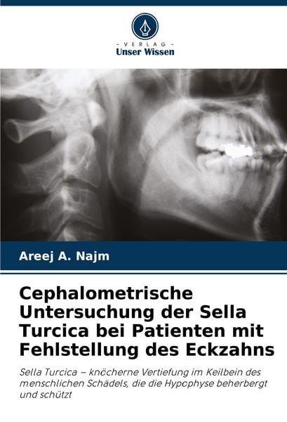 Produktbild: Cephalometrische Untersuchung der Sella Turcica bei Patienten mit Fehlstellung des Eckzahns