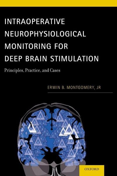 Produktbild: Intraoperative Neurophysiological Monitoring for Deep Brain Stimulation