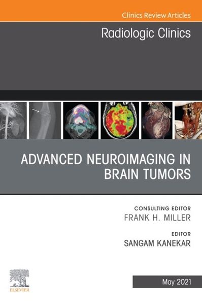 Produktbild: Advanced Neuroimaging in Brain Tumors, An Issue of Radiologic Clinics of North America, E-Book