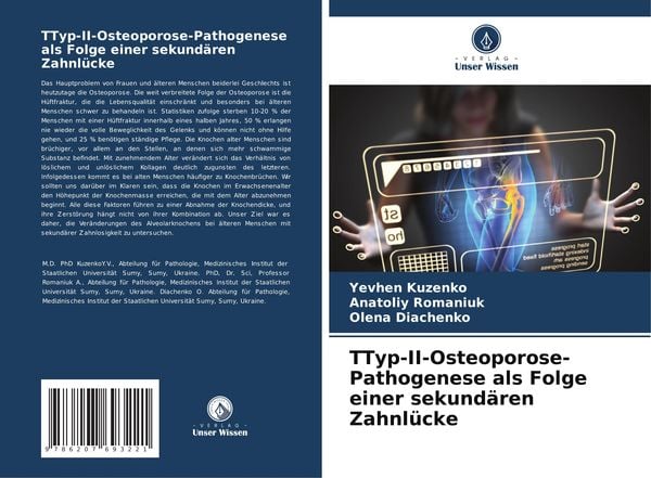 Produktbild: &iquest;Typ-II-Osteoporose-Pathogenese als Folge einer sekund&auml;ren Zahnl&uuml;cke
