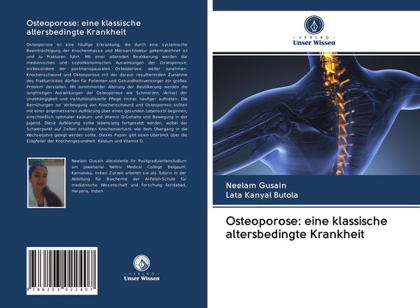 Osteoporose: eine klassische altersbedingte Krankheit, Taschenbuch von Neelam Gusain , Lata Kanyal Butola, Verlag Unser Wissen, 9786203022407